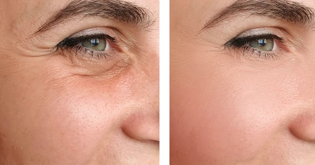 Choice Of Botox Injections National Deal other Shop Online at Dubai Trades 3