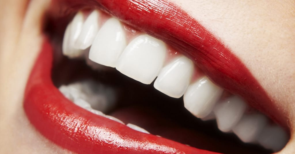 Dental Check-Up With Optional Stain Removal, Or Laser Teeth Whitening Dubai other Shop Online at Dubai Trades 2