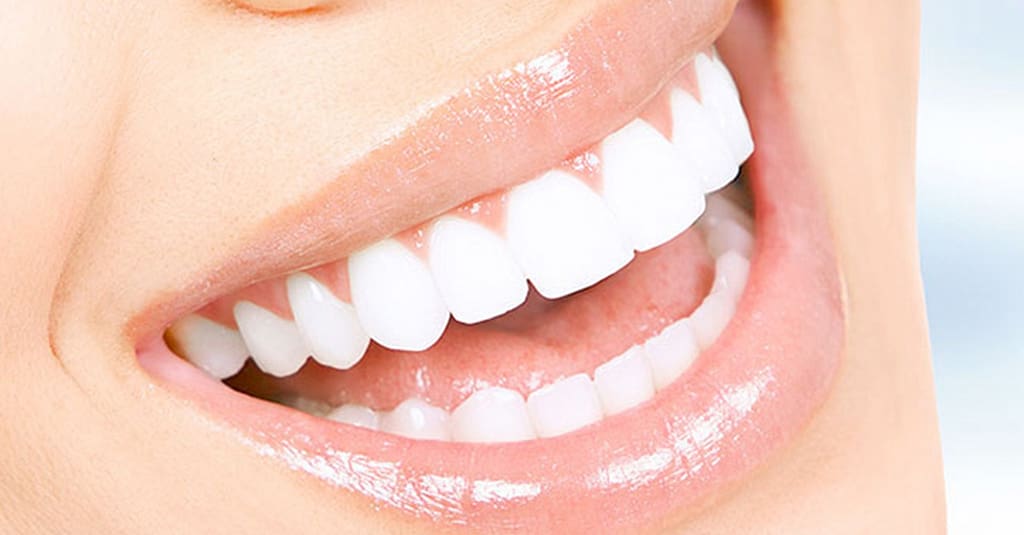 Scaling And Polishing With X-Ray At Omar Yahia Dental Surgery Clinic Dubai other Shop Online at Dubai Trades 2