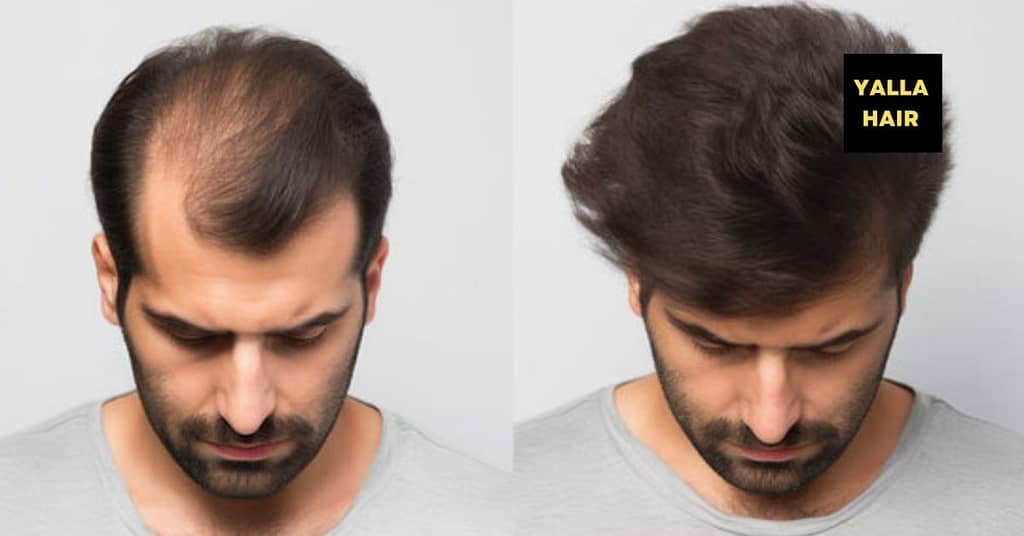 Extensions / Feathering Dubai other Shop Online at Dubai Trades 2