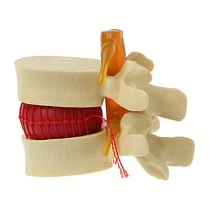 Lumbar Disc Herniation Demonstration Model – Pvc Material, English Language, Scientific Education Animal Anatomy Models Business, Industry & Science Shop Online at Dubai Trades