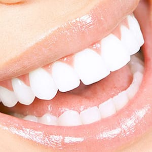 Scaling And Polishing With X-Ray At Omar Yahia Dental Surgery Clinic Dubai other Shop Online at Dubai Trades