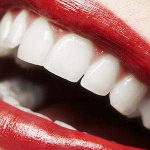 Dental Check-Up With Optional Stain Removal, Or Laser Teeth Whitening DENTISTRY Shop Online at Special Price from Dubai Trades
