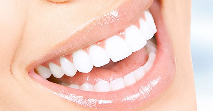Scaling And Polishing With X-Ray At Omar Yahia Dental Surgery Clinic Dubai other Shop Online at Dubai Trades 2
