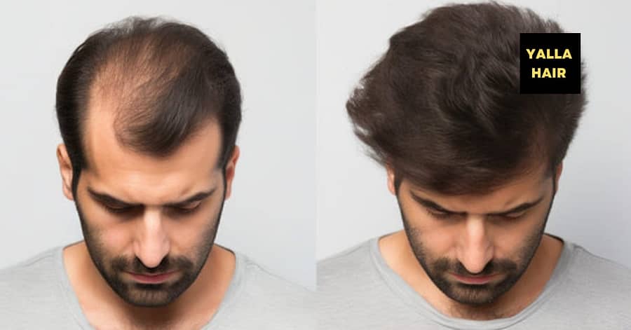 Extensions / Feathering Dubai other Shop Online at Dubai Trades 2